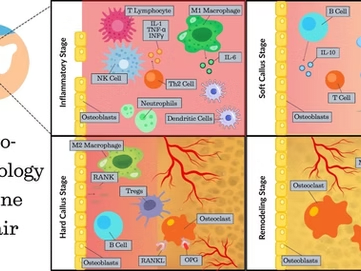 Immune System and Bone Healing: Understanding the Connection
